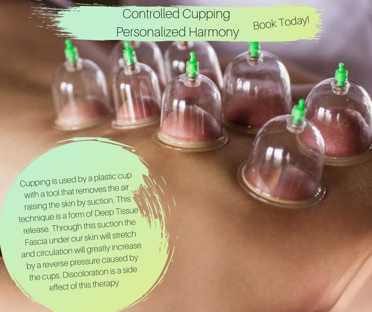 This is how our service works, and this is your usual outcome. Cupping ...